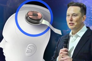 Musk Hopes For Neuralink Chip Human Implantation To Be Carried Out In 2022!