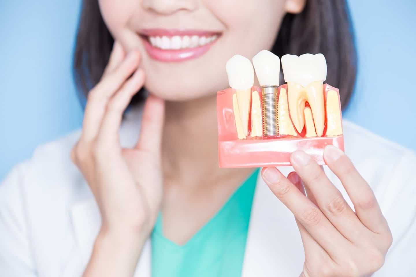 Types of Dental Implants & Techniques